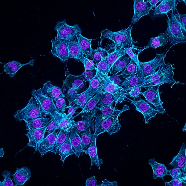 Fluorescent cell microscopy
